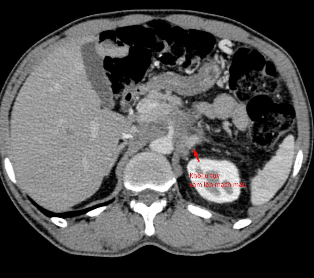 z7311009275194b14e024ea62f5f1cb43f5b5d0b3093cb