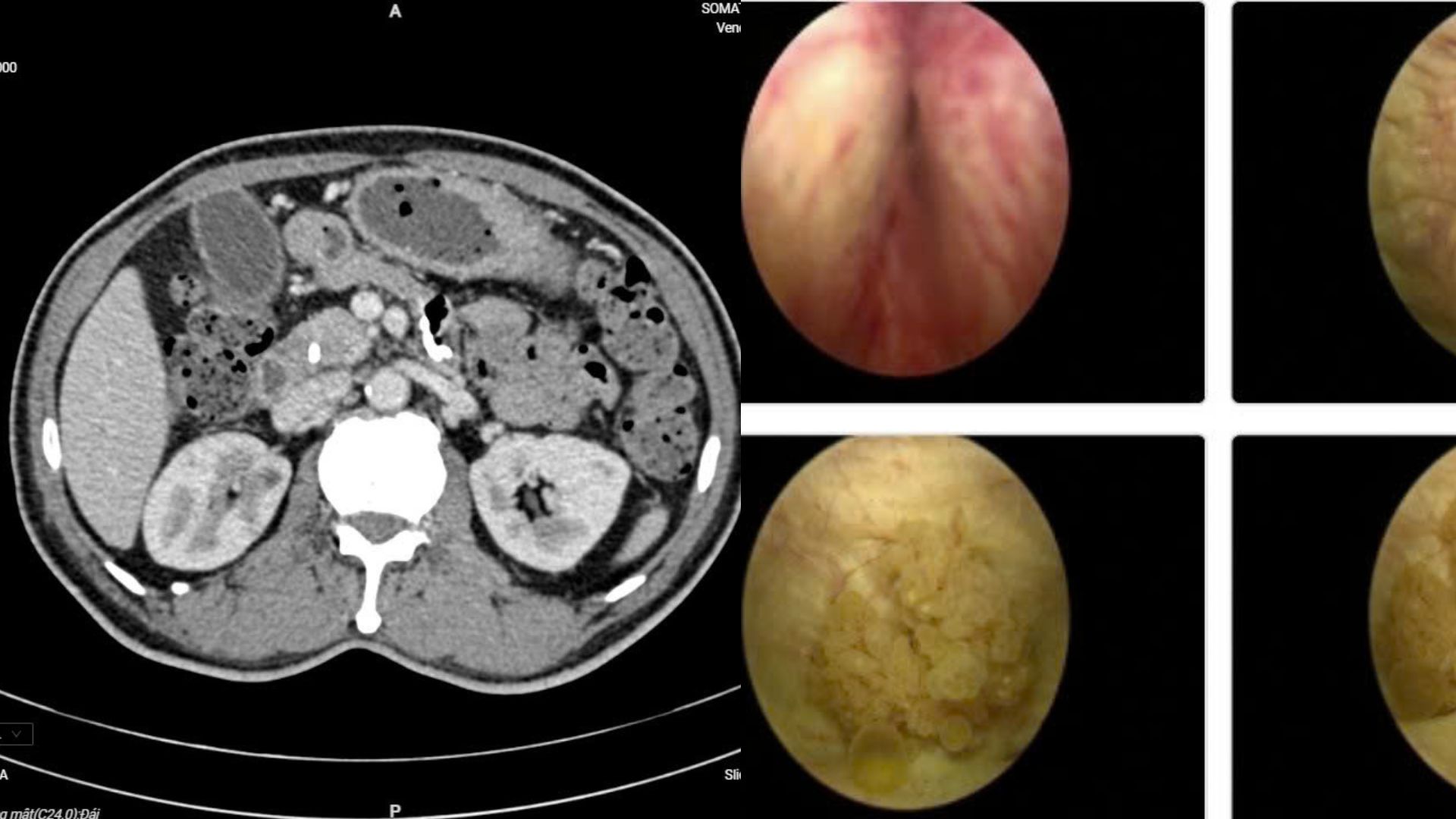 hat nano nhua co the truyen tu me sang thai nhi o chuot 2