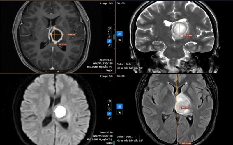 65092669333820570752779562039284108700307283n
