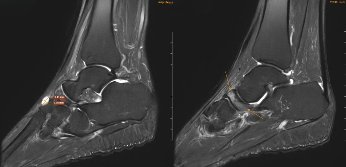 65976046033966478204855485441575800378865532n