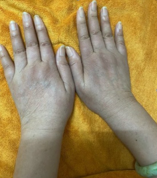 65911237534008066734029961381589572289108321n