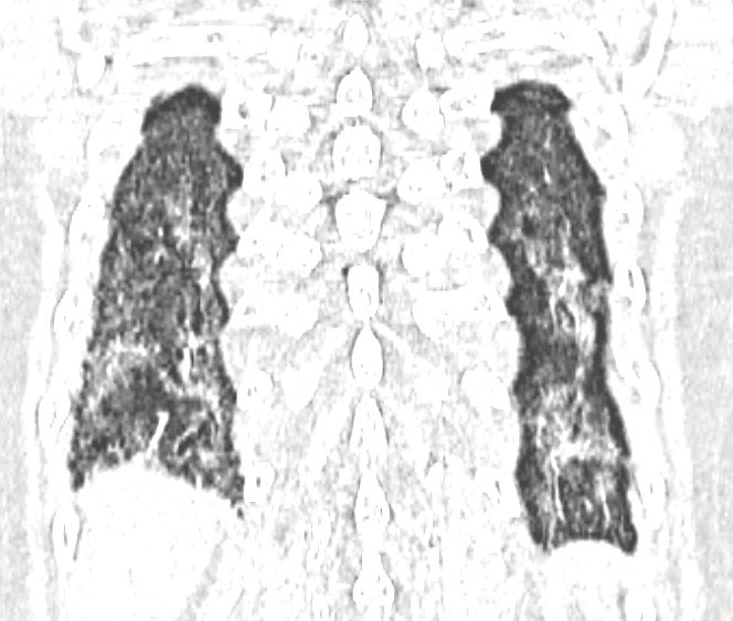 66015091234008066300696676748498377502383336n