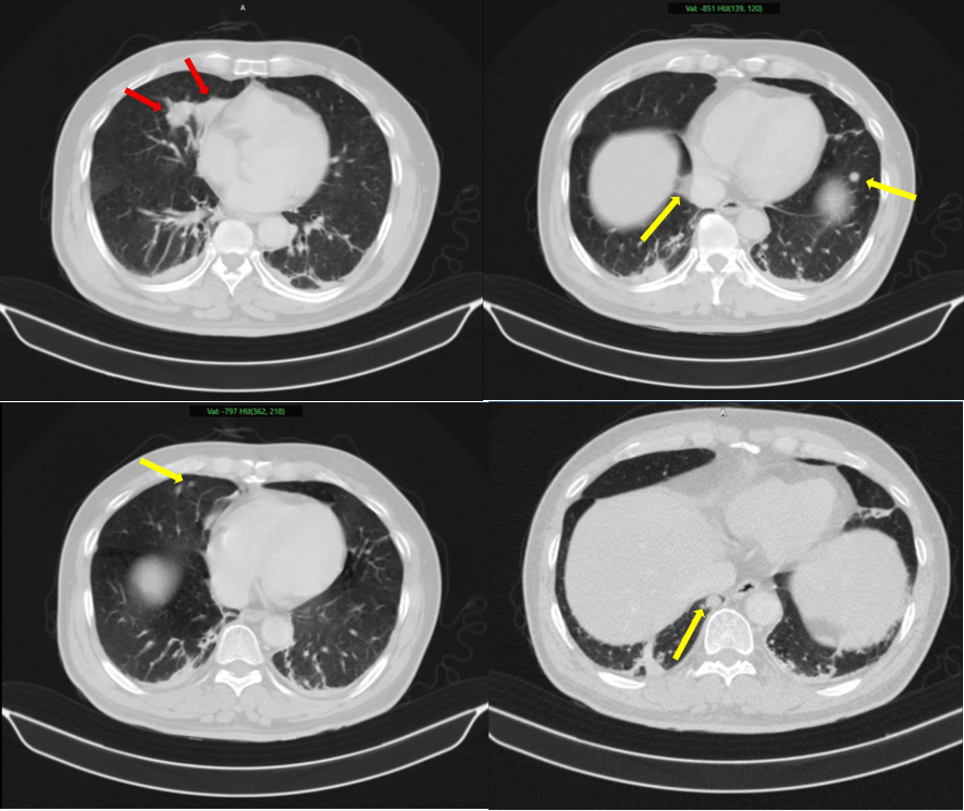 c736bae2 e744 44cc a2b0 1f18e30e5d72mceu95627040411774408784766