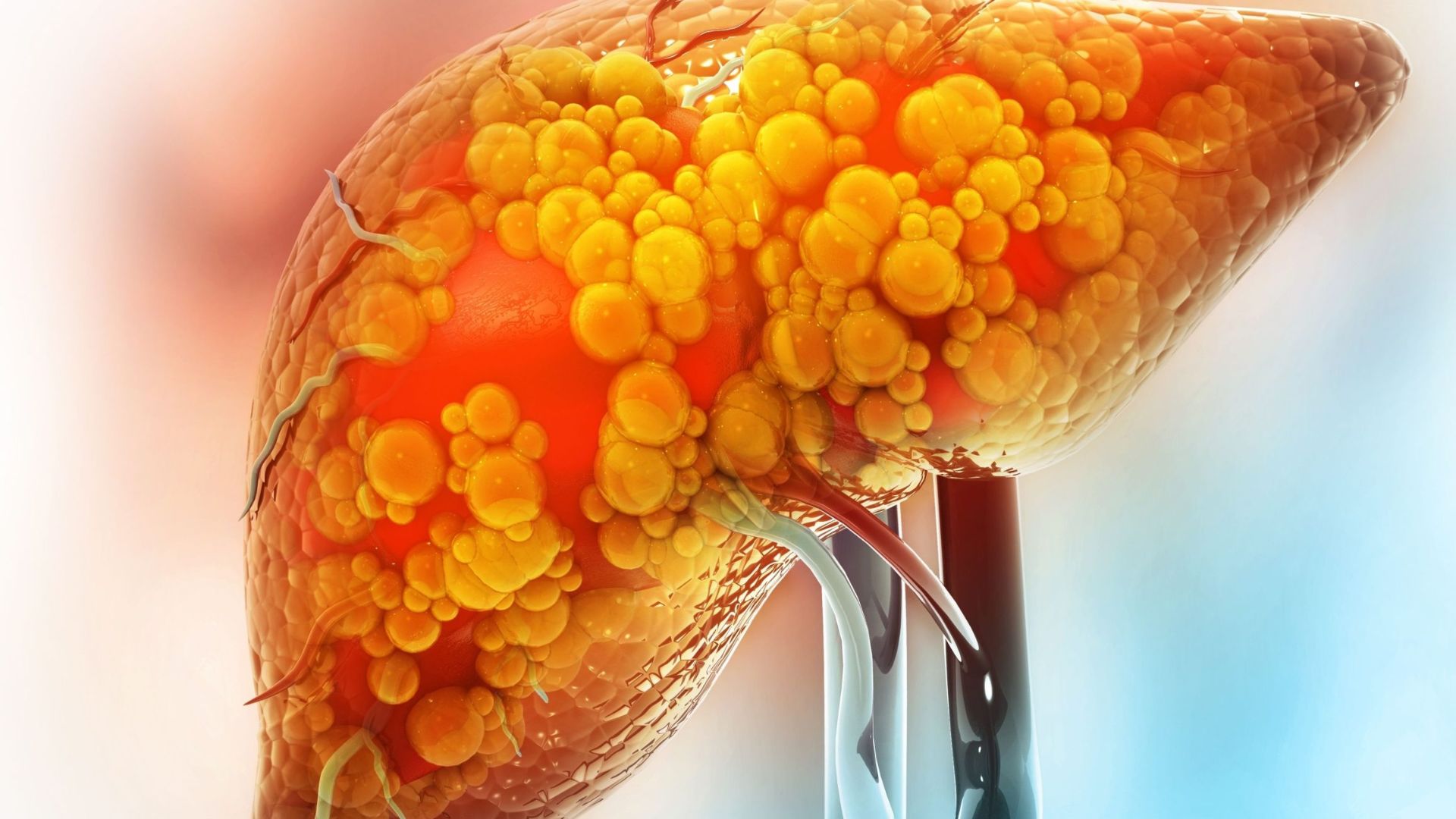 gannhiemmodo1conguyhiemkhongnguyennhannguycovahuongdieutri23ad14a7c80