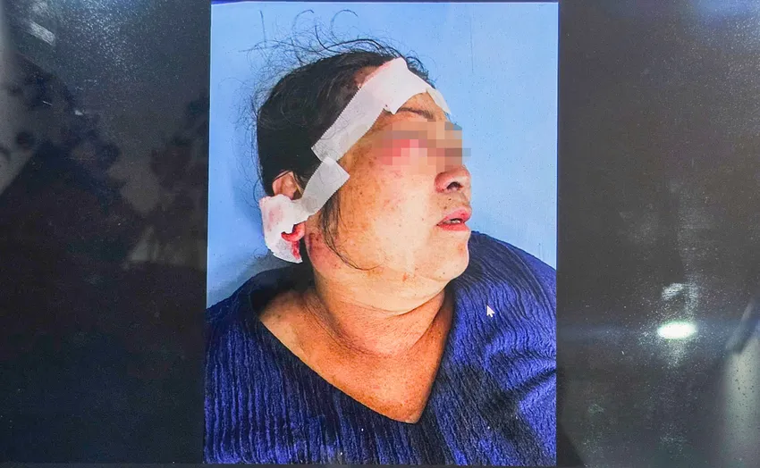 bi hanh hung 86 7243