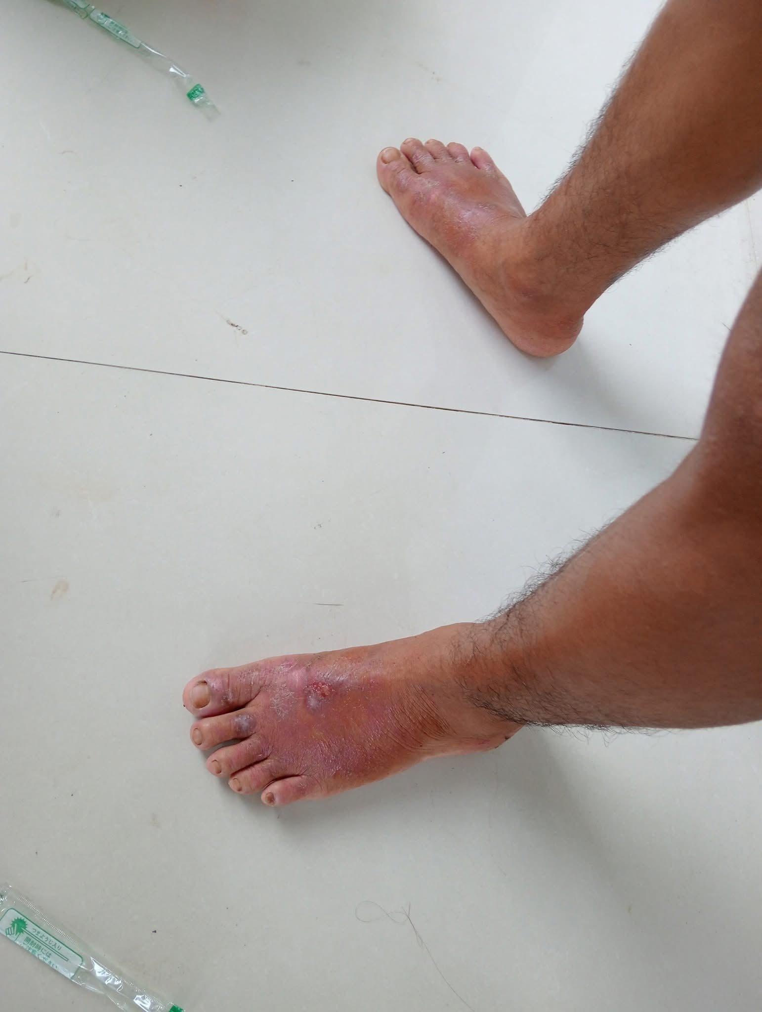 57227904614157378232474173568568149277294928n 57227904614157378232474173568568149277294928n