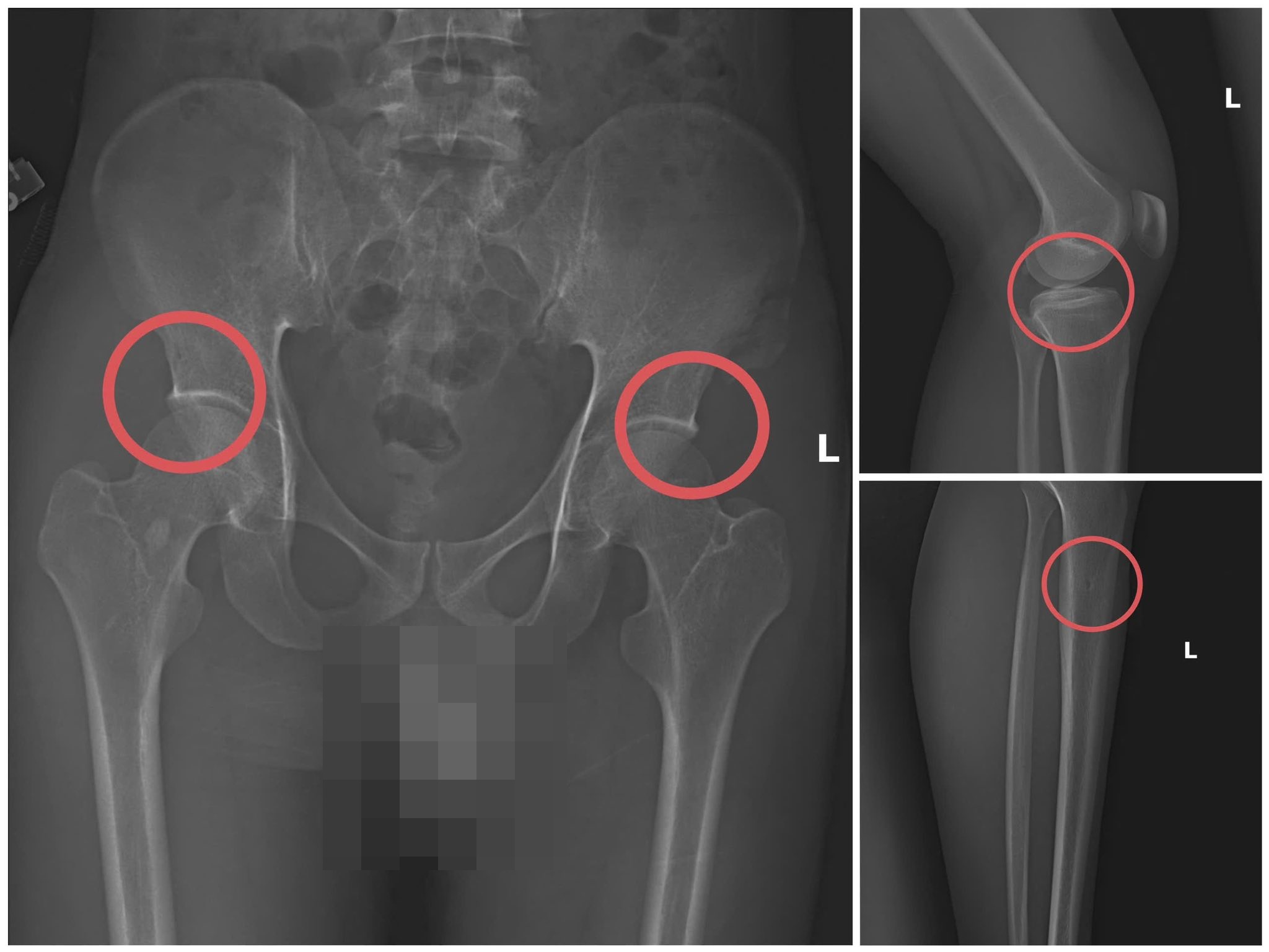 58212652711616106294328222146826199602850704n1