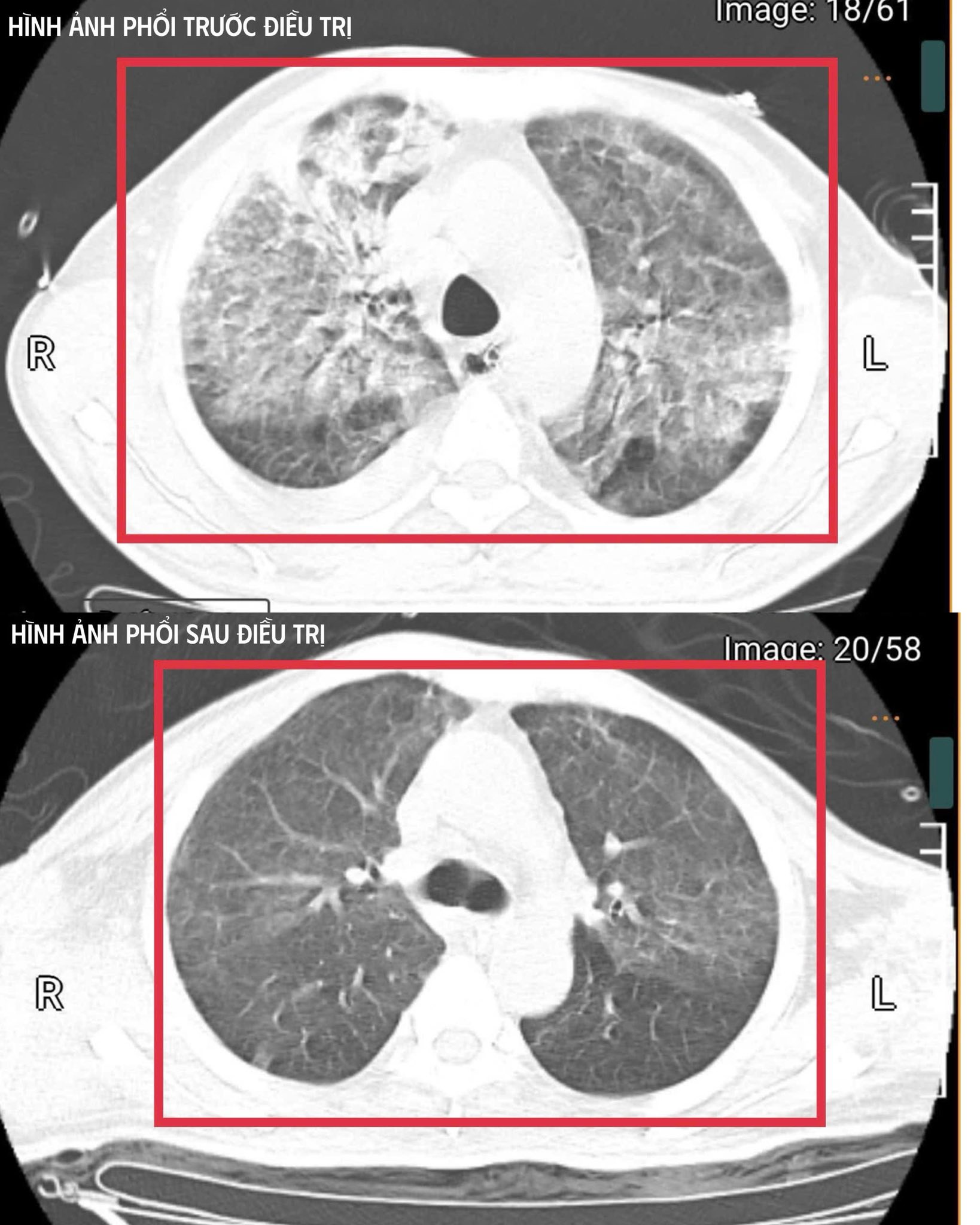 597708934882656054420293927381799833305406n