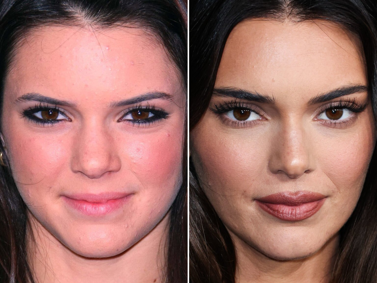 kendall jenner before and after