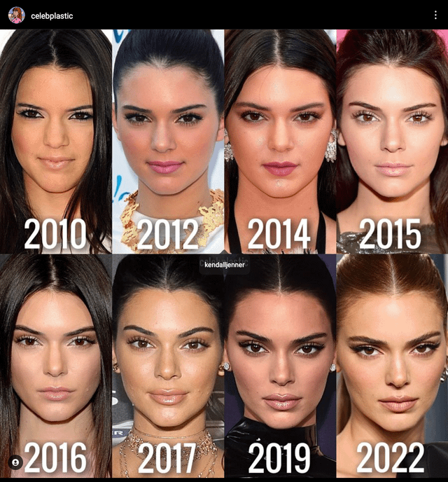 rate kendall jenner before and a