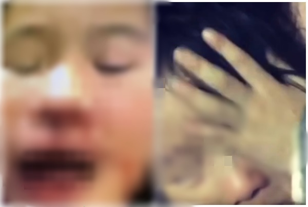 121