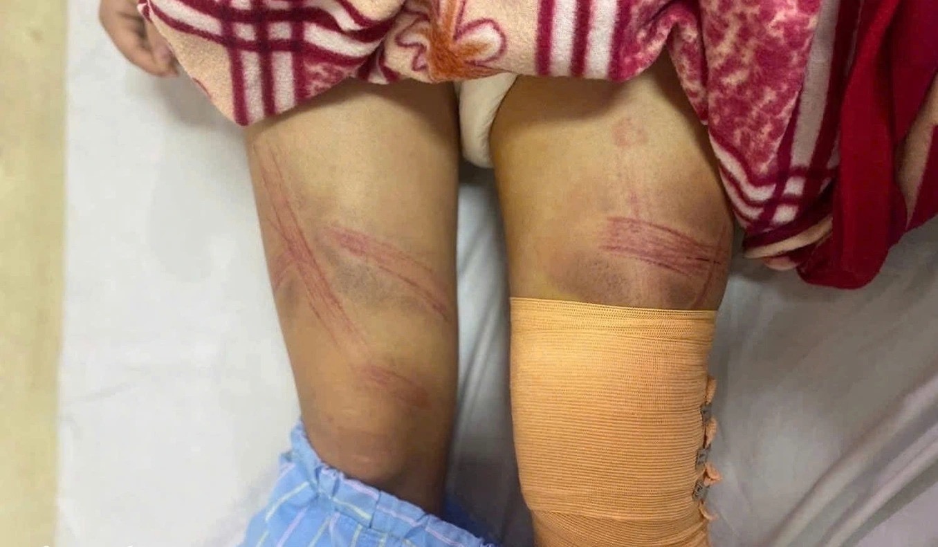 60394328815502143828677705134282324807996351n