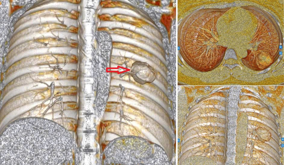 60481627833030913098412008475316466897445151n