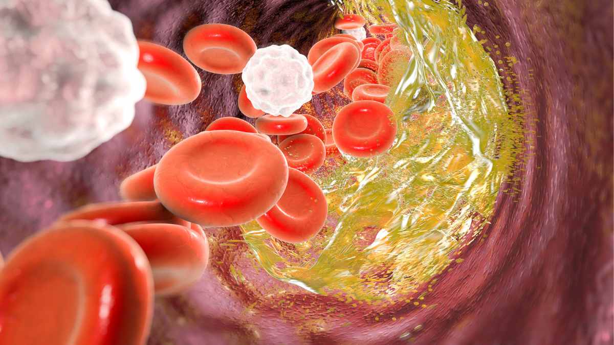 cholesterol trong mau