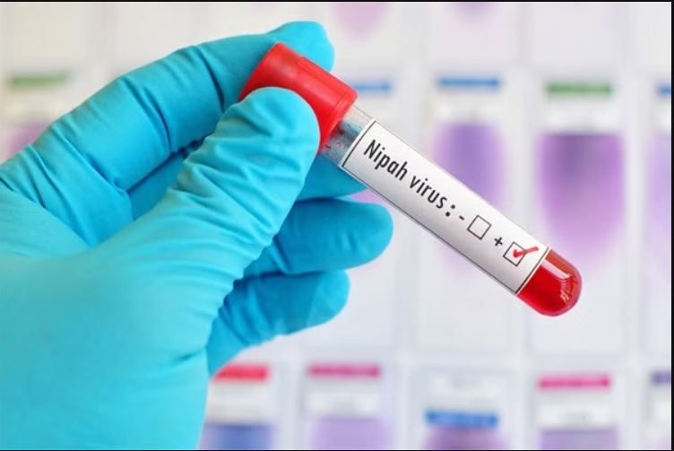 virus nipah 2