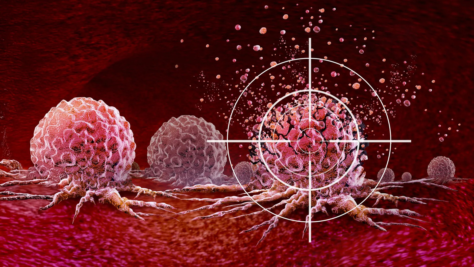 Ung thư rất ‘thích’ 2 loại thực phẩm này, chuyên gia cảnh báo: 