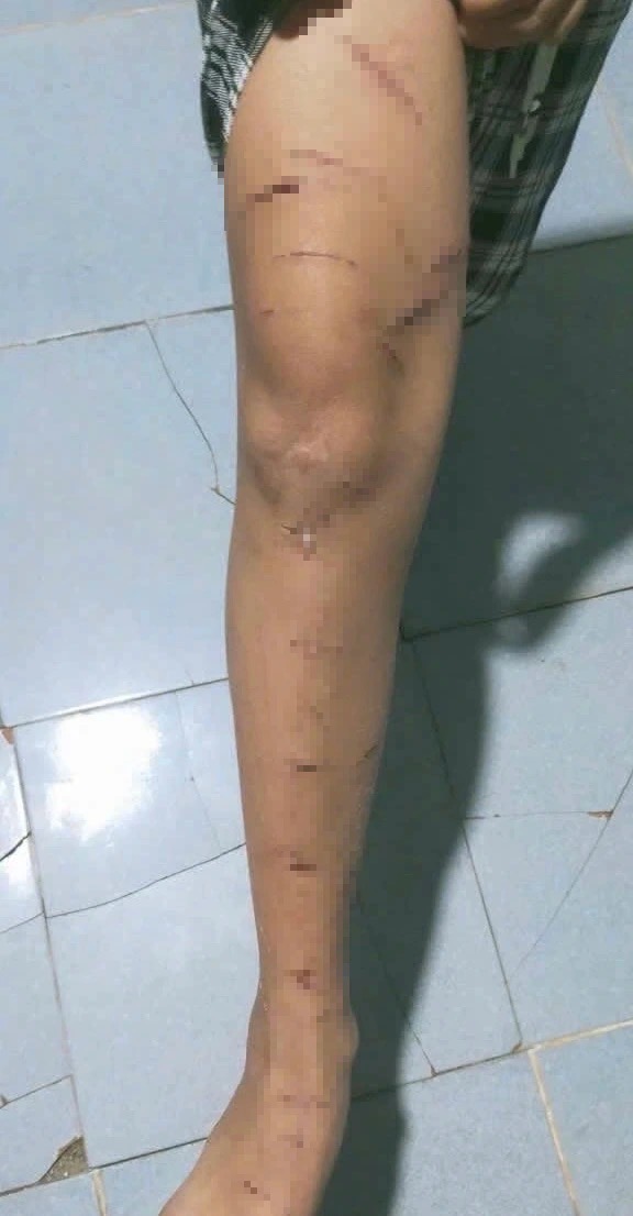 62183038030684867300019721330054156126741435n