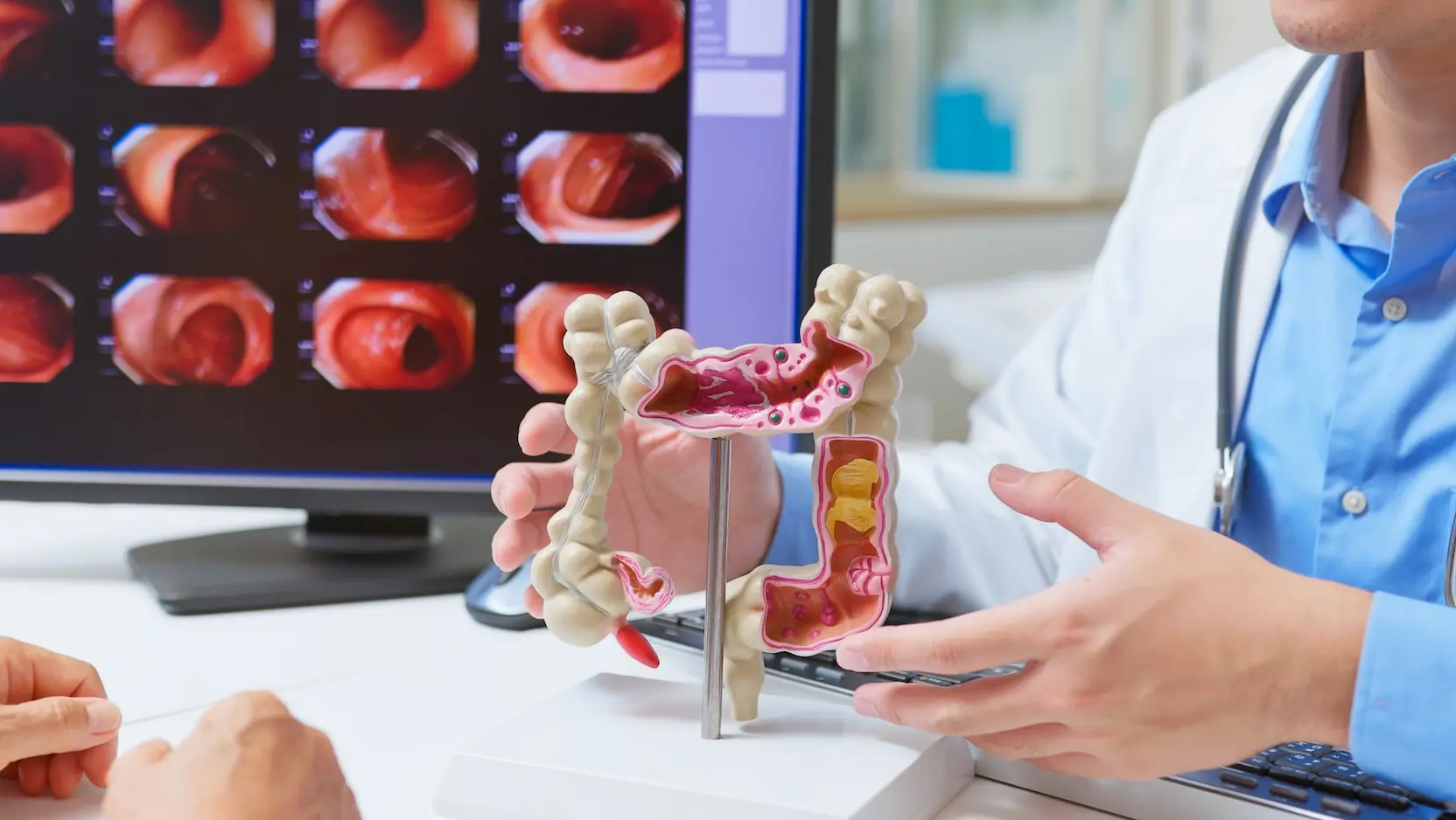 over 50 colon cancer universal 1664x938