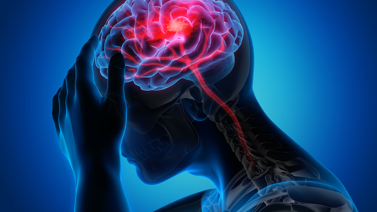 signs symptoms stroke