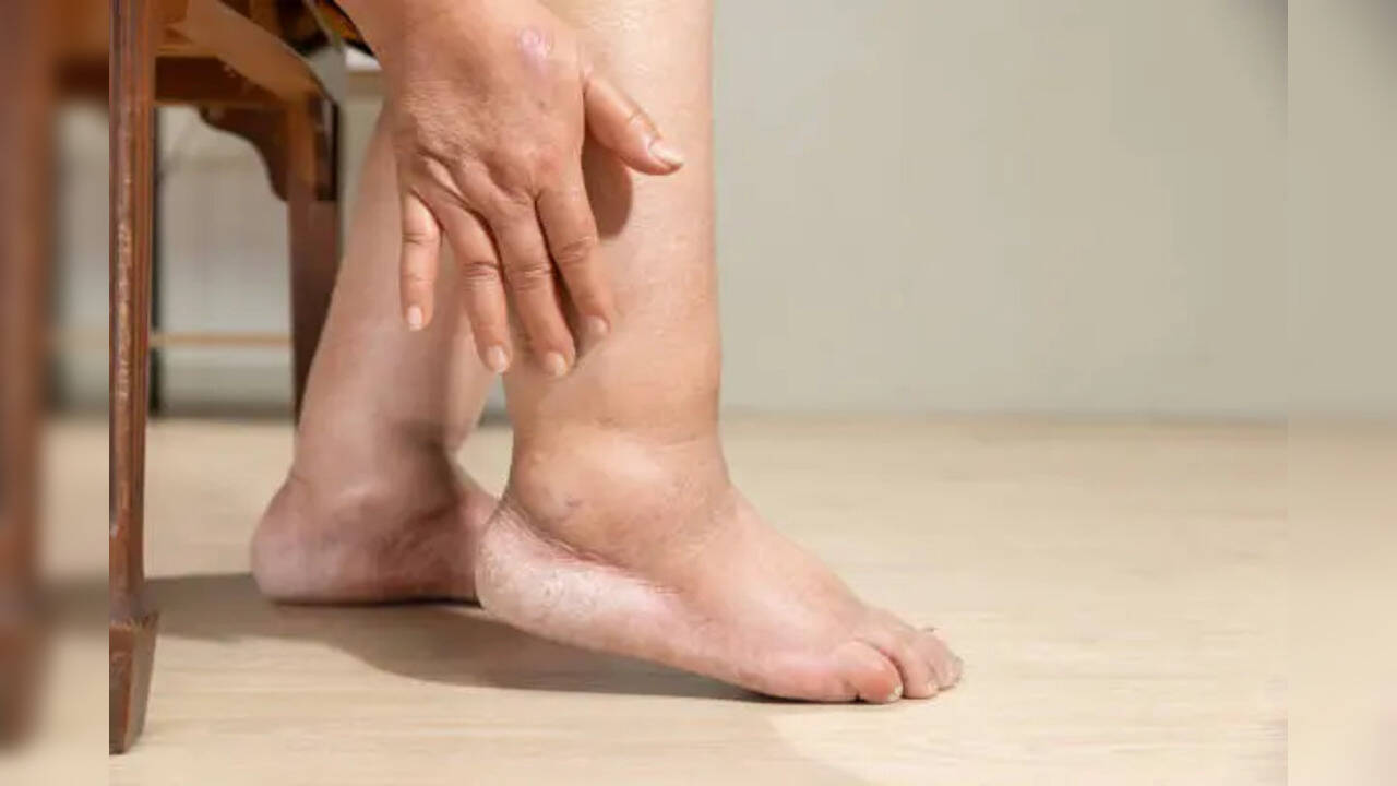 sung phu chan dau hieu benh than