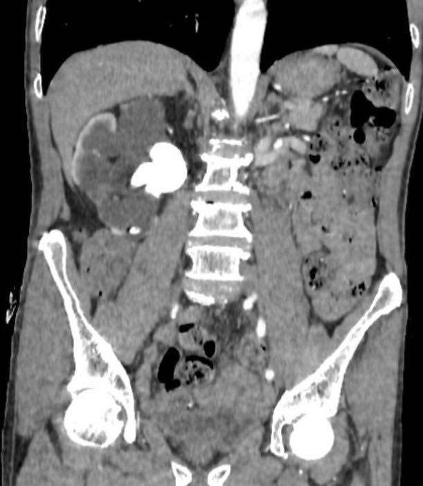 649575596260262436870313954349534978767556384n