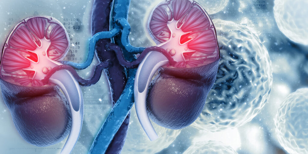 centre transplant renal 1024x514