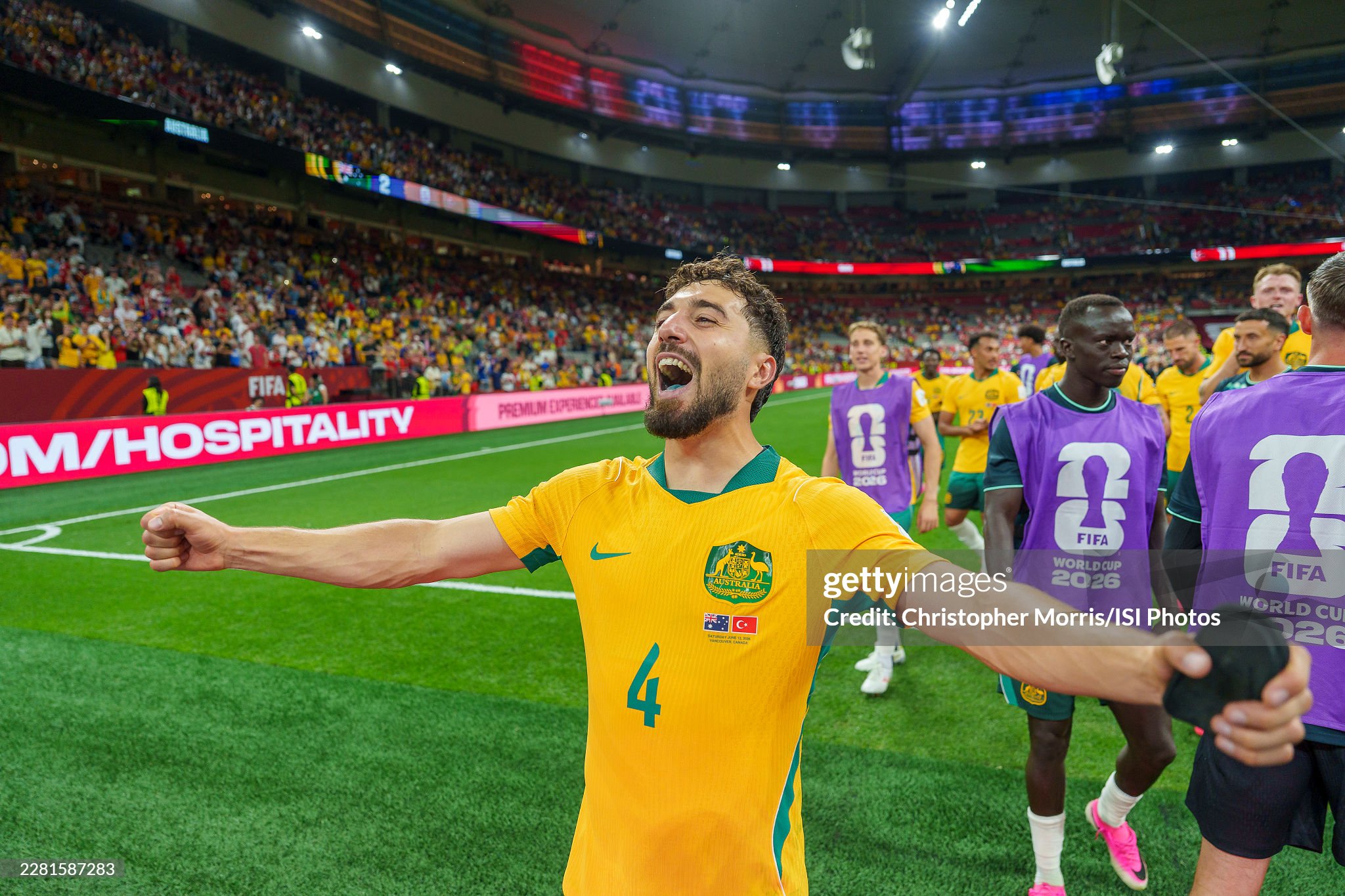 gettyimages 2281587283 2048x2048