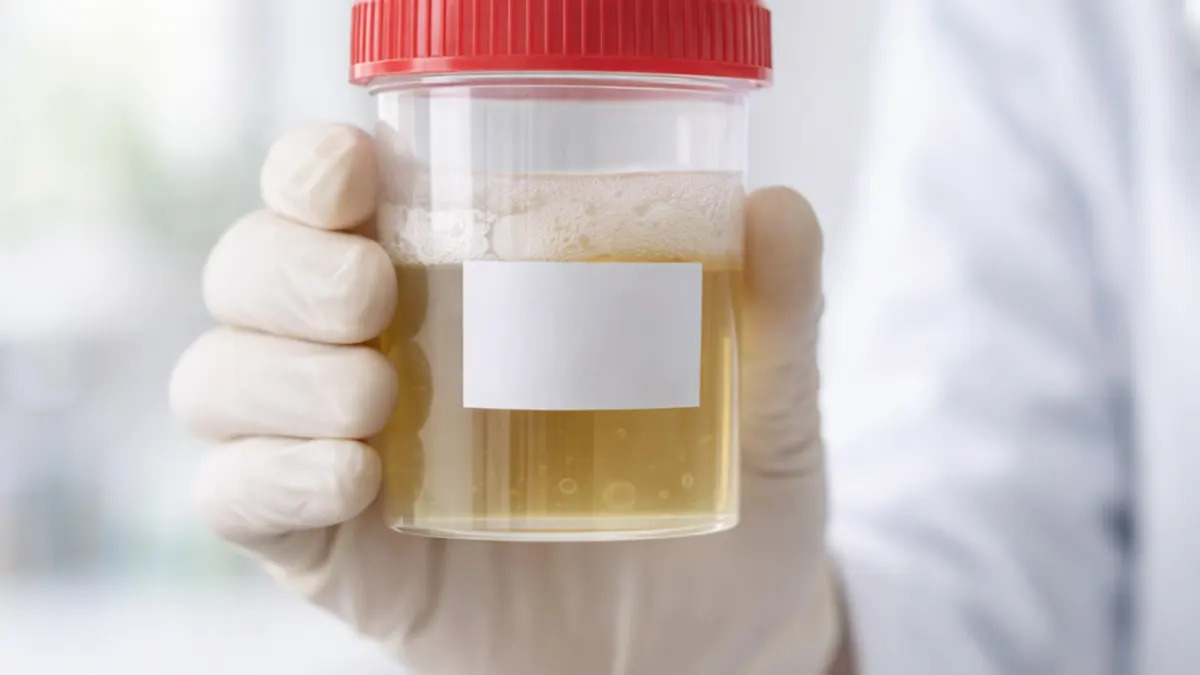 foamy urine causes concerns