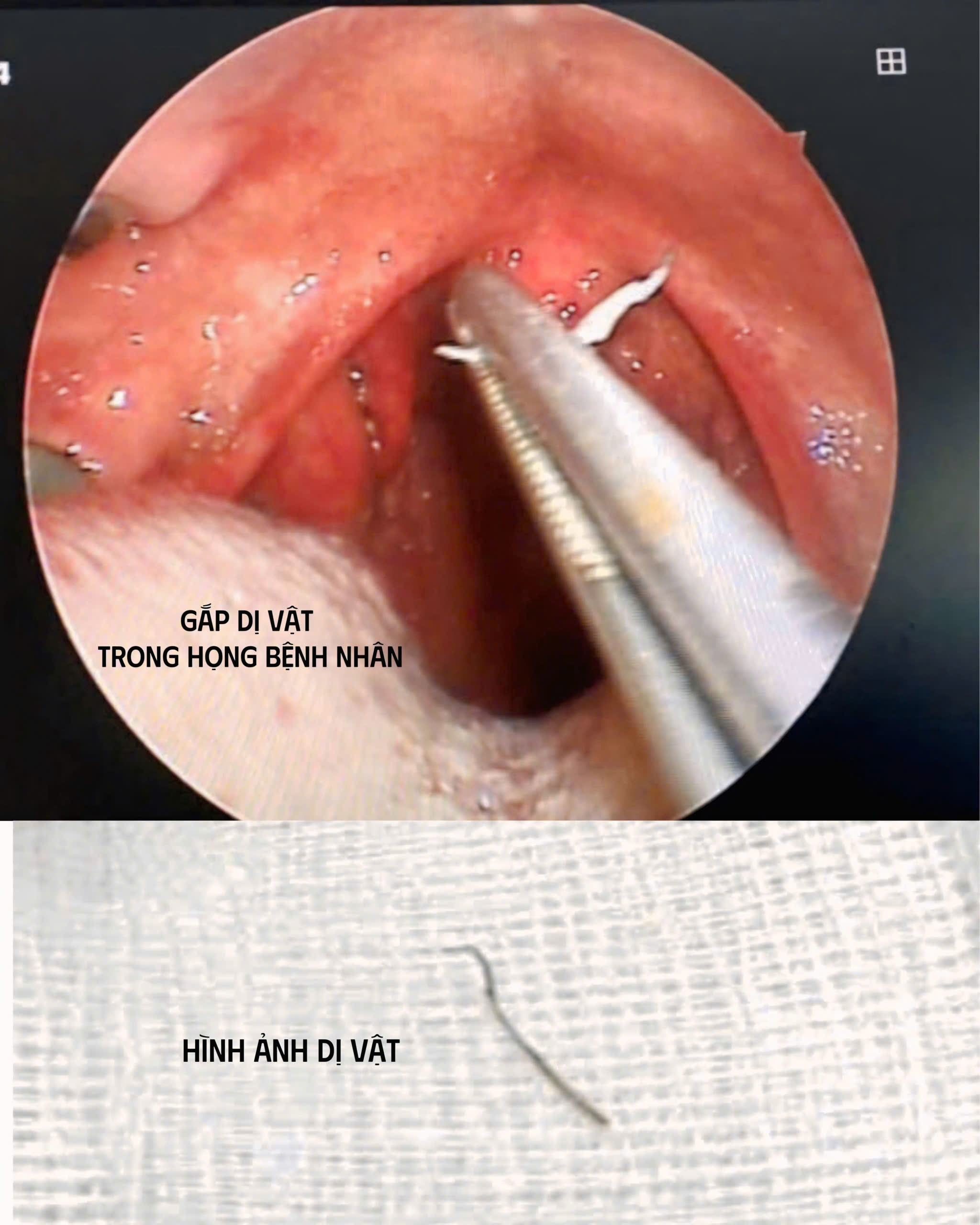 z64939017203116d4b8fb7f8490f0bfa744030cdea49b5