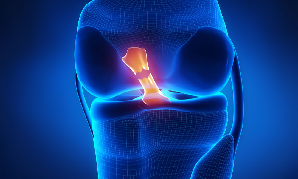 chan thuong thuong gap khi choi pickleball tennis cau long2