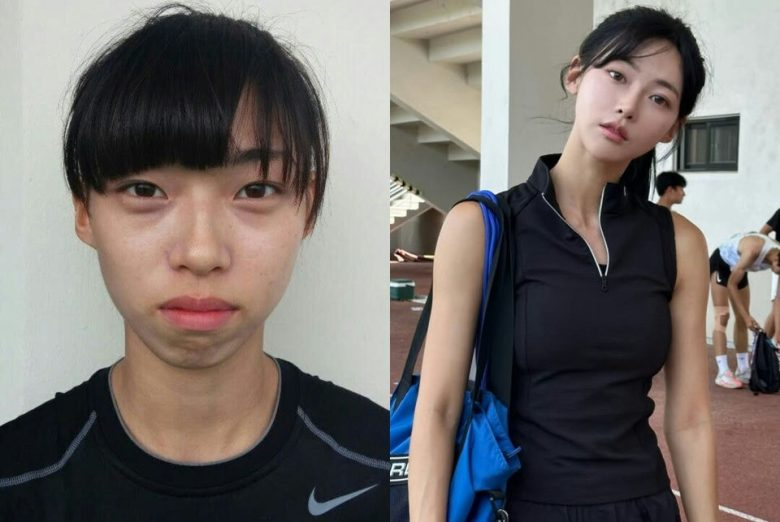 kim min gee plastic surgery rumo