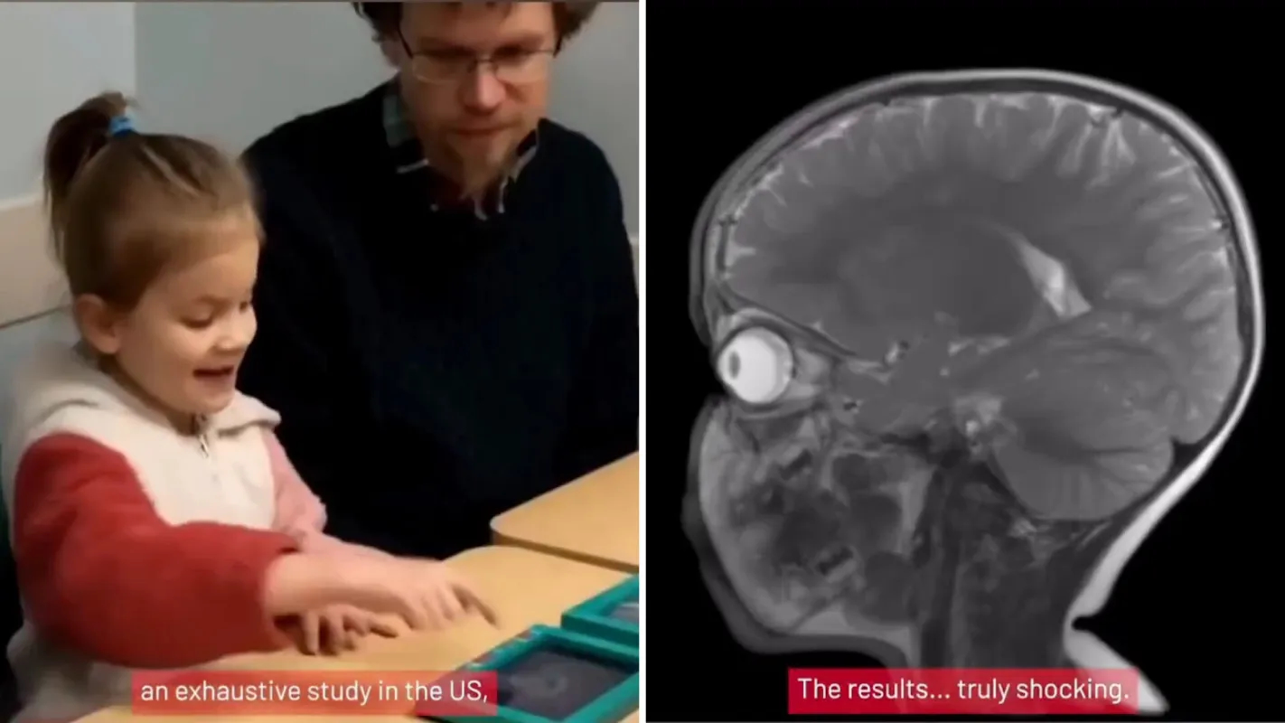 brain study recidqxagviviqctp