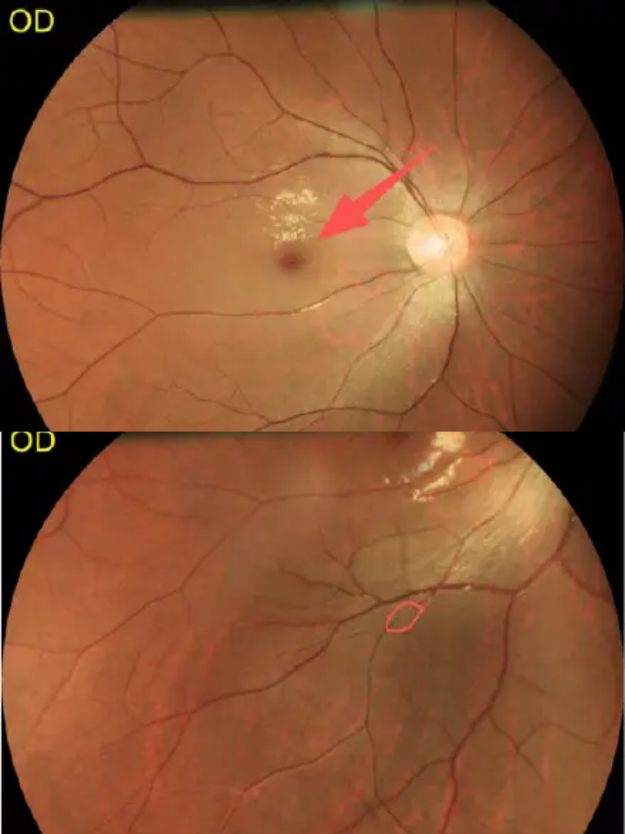 nguoi dan ong 24 tuoi dot nhien mu loa bac si chi dich danh thu pham la loai nuoc hiem nguoi tre nao khong me anh1