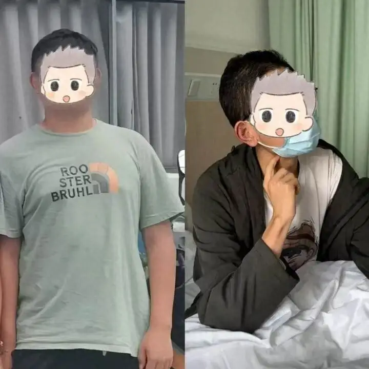 chang trai 20 tuoi nhap vien sau khi giam 36kg bac si hoang hot an va tap the nay khac gi pha mien dich anh1