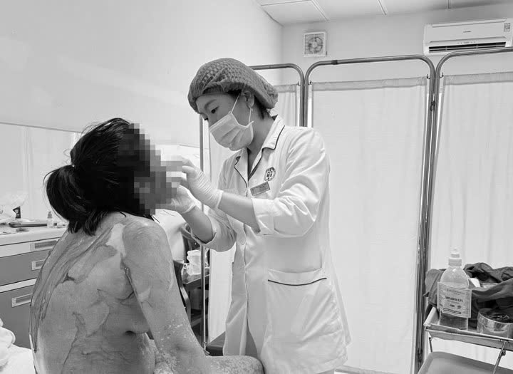 hai phong 1 phu nu 35 tuoi bi troc da nhu cua lot vi thoi quen dung thuoc cuc ky pho bien anh2