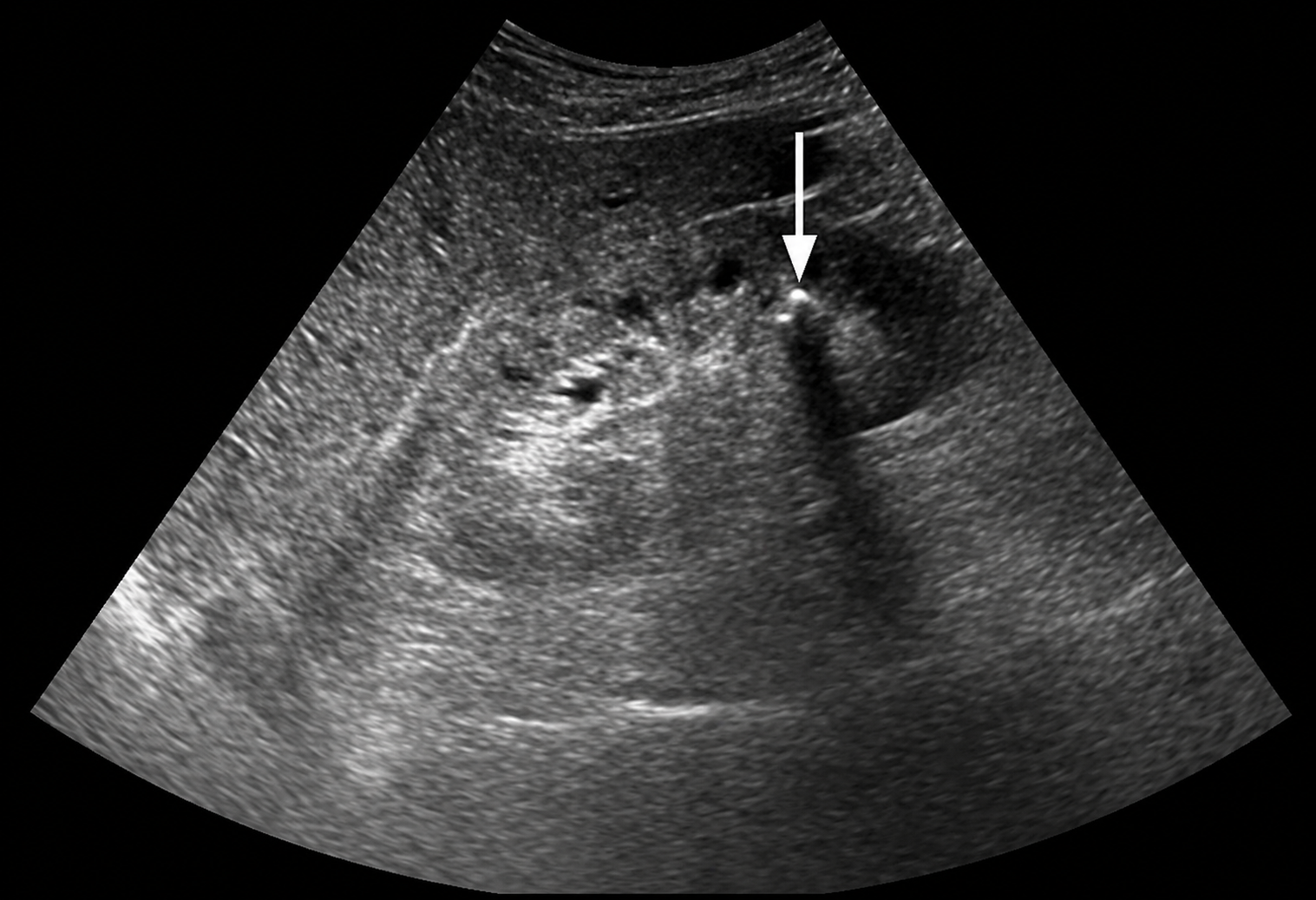 nu nhan vien van phong cap cuu vi dau lung du doi sau khi uong vien sui bo sung vitamin c anh1