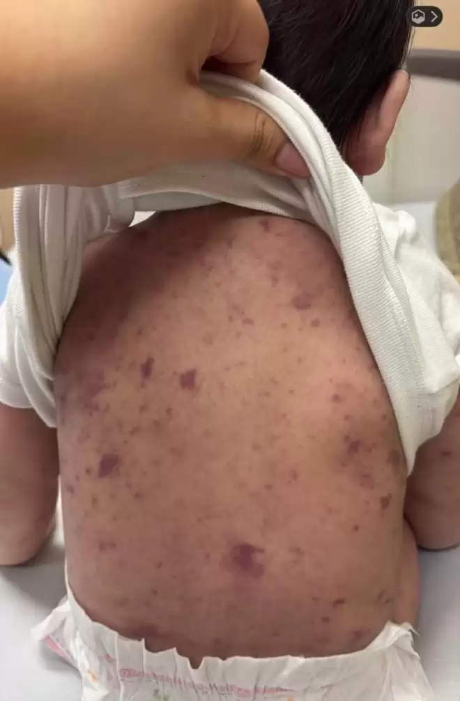 be trai 11 tu vong sau khi cho doi bac si suot 5 tiengdong ho anh3