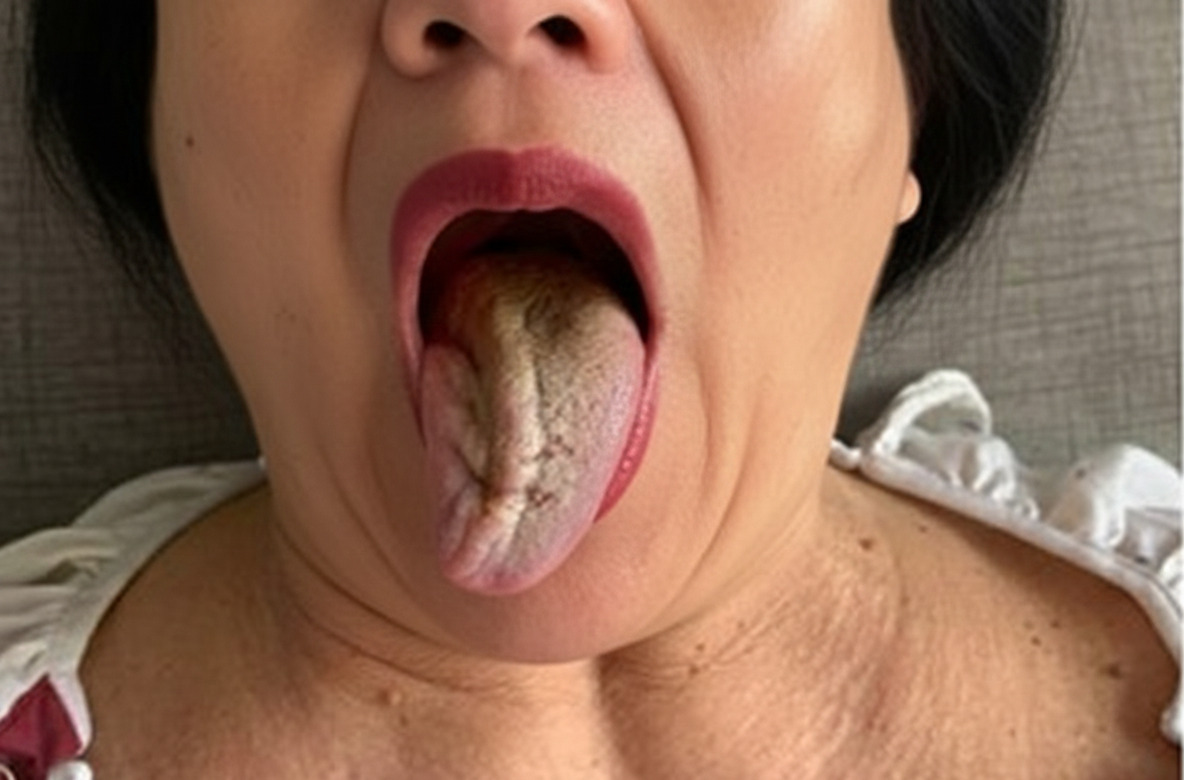 luoi la guong bao benh thay 5 thu nay chi e gan than nao deu da gap nguy anh2