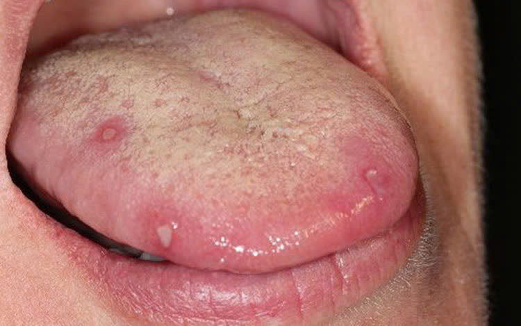 luoi la guong bao benh thay 5 thu nay chi e gan than nao deu da gap nguy anh3