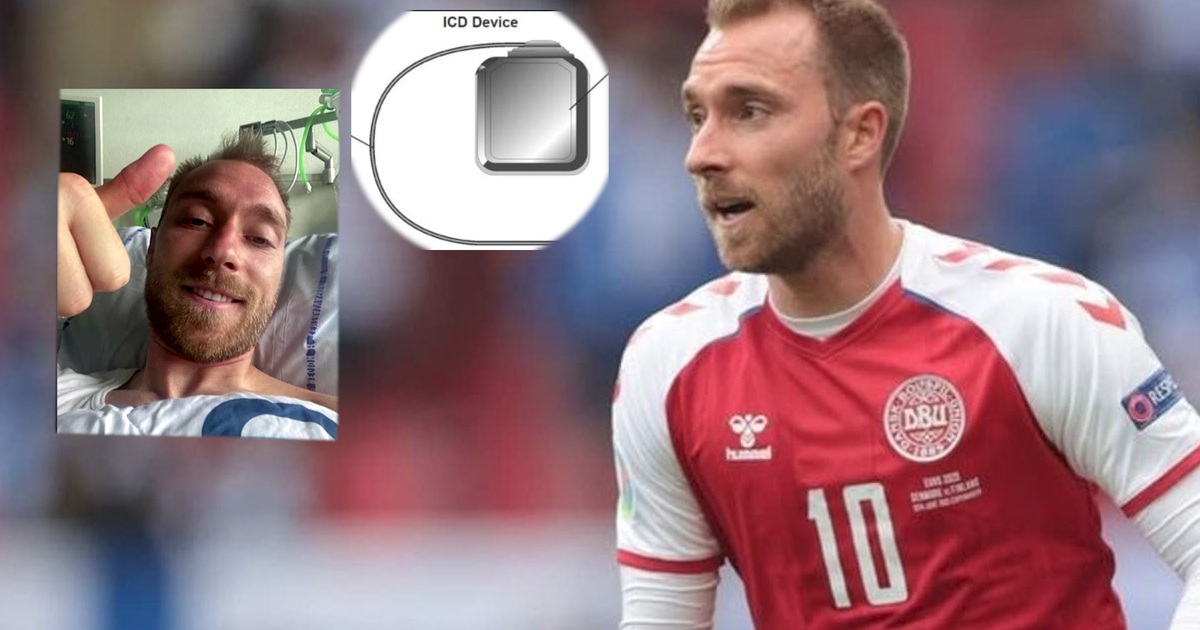 eriksen icd 162394614379951059903yjpy