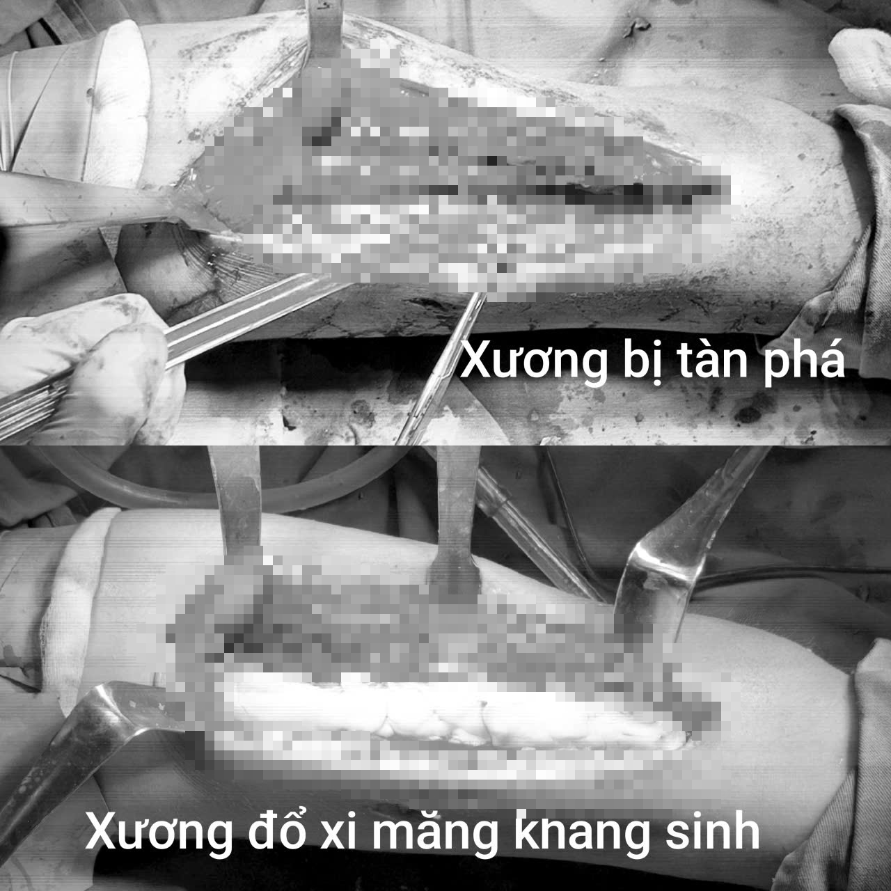 edit x1 17812391043531363939354
