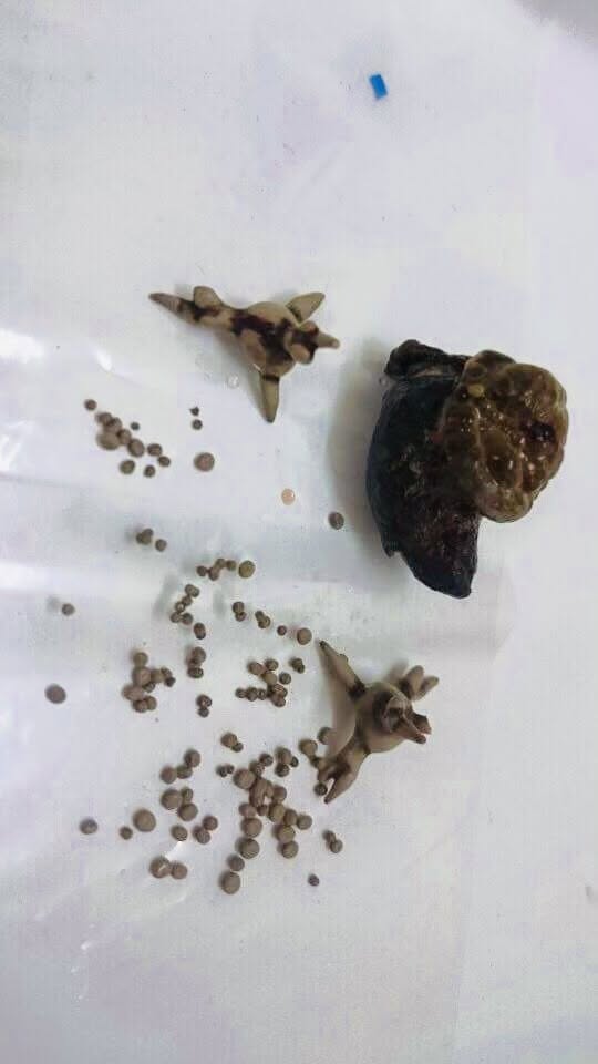 b2