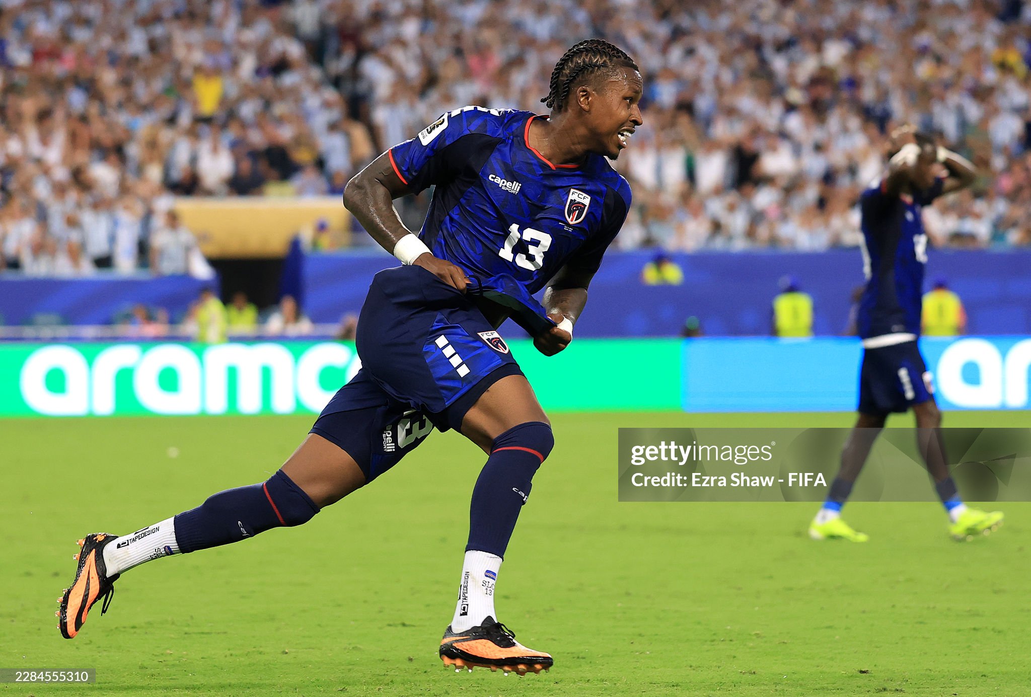 gettyimages 2284555310 2048x2048