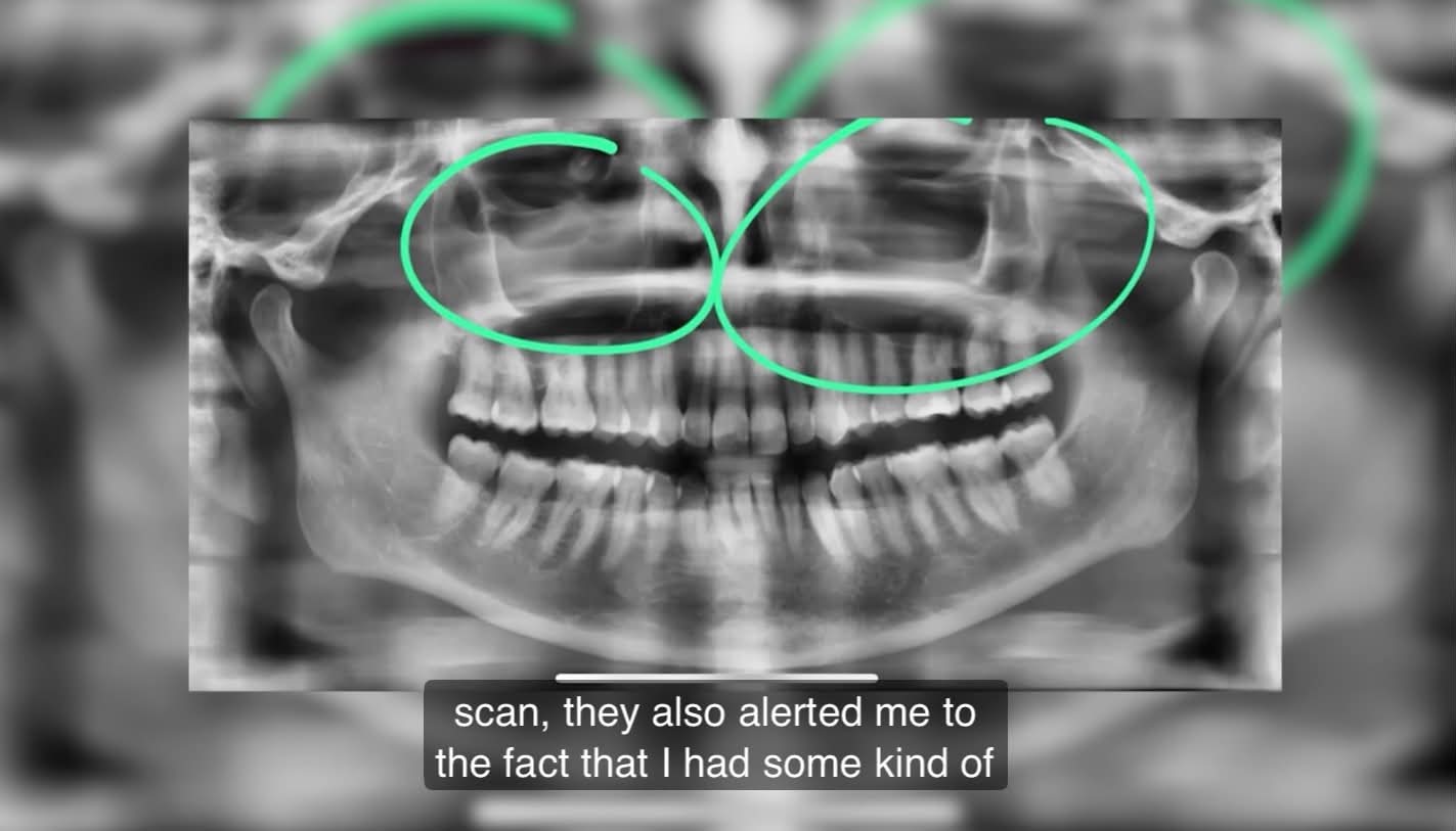 a7a