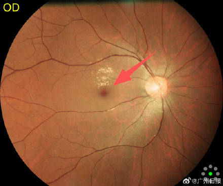 25659af478614b27b4274434c103a947