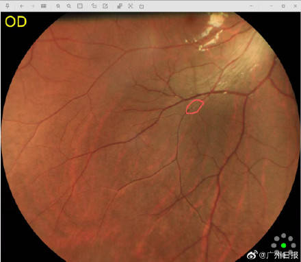 9a97cedfdd4f4ef0a197e4ac0fca1b7c