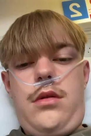0pay knmvapingnearlykillste 2