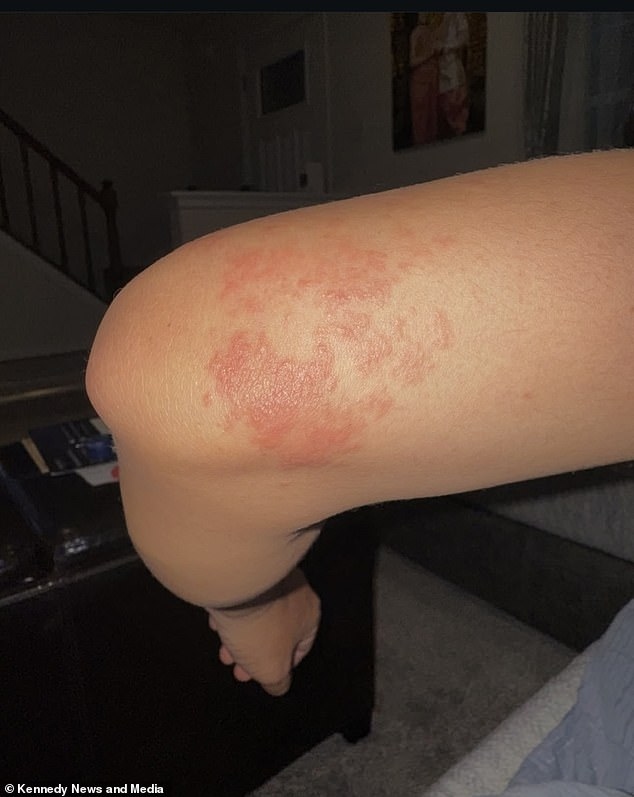 96031863 14481831 image a 61741