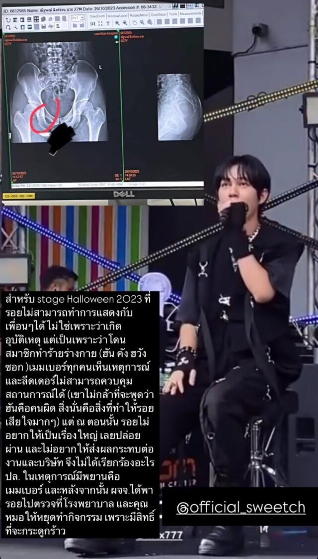 gpeb9gobeaexbpn 1 640x1123