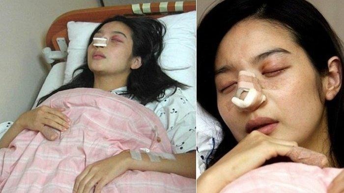 kondisi lee min young setelah di